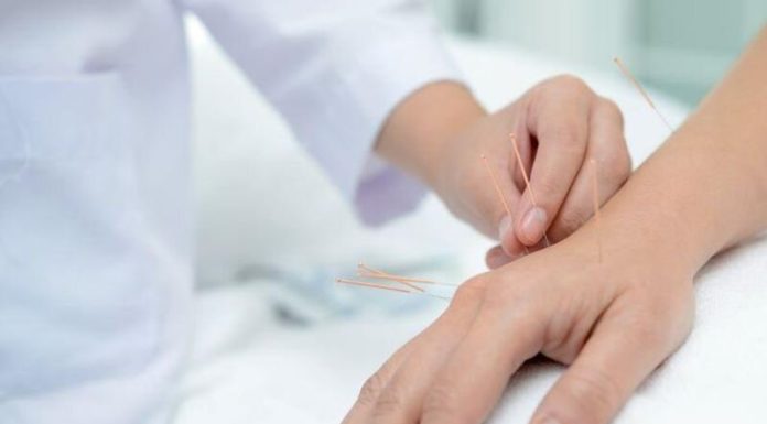 Adjunctive acupuncture might pace reduction from ache of renal colic