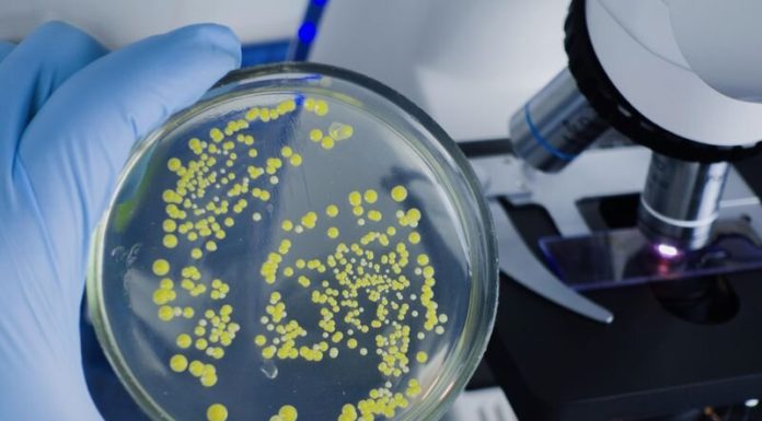 CDC investigating E. coli outbreak in Michigan, Ohio