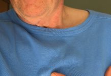 Affected person model of pointers to forestall coronary heart illness launched