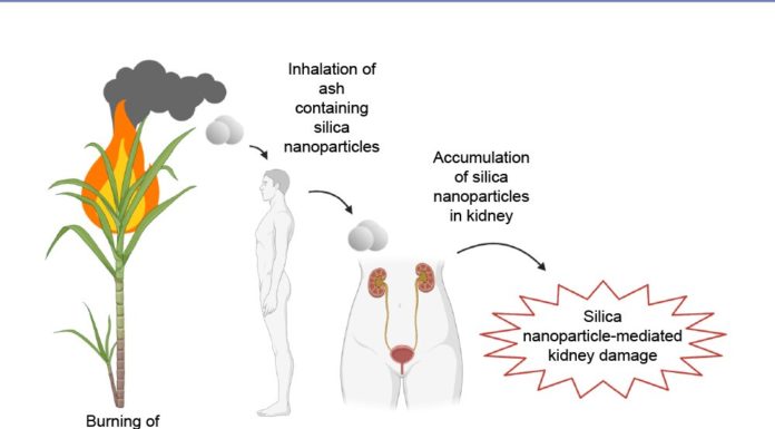 Inhaling silica particles could trigger kidney illness