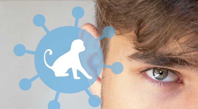 Does washing garments get rid of monkeypox? What to learn about disinfecting for the virus