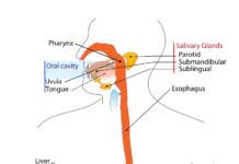 Profiling pancreatitis