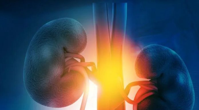 When eradicating a giant kidney stone, get the little ones, too