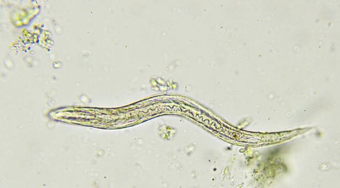 Why do my youngsters hold getting worms? And is that what’s making them so cranky?