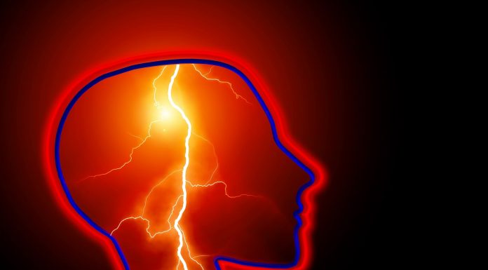 Consultants say time is most important issue for higher stroke outcomes