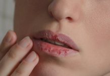 4 fast and simple house treatments for dry lips
