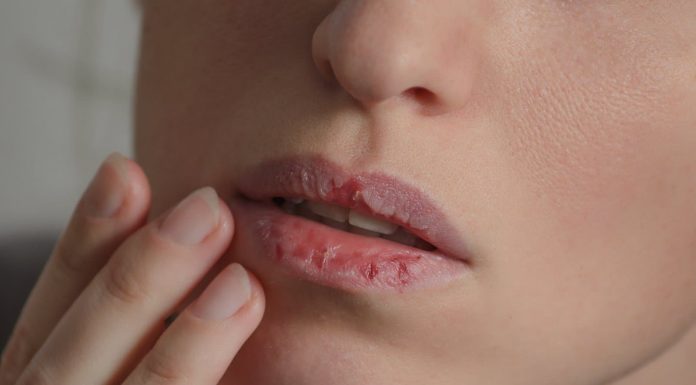 4 fast and simple house treatments for dry lips