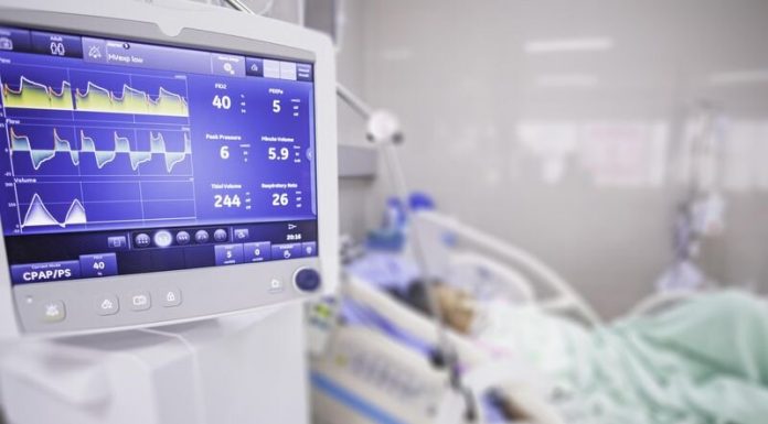 Early mobilization not helpful for ICU sufferers