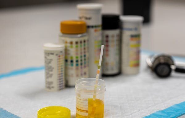 Is urine sterile? Do urine ‘therapies’ work? Specialists debunk widespread pee myths