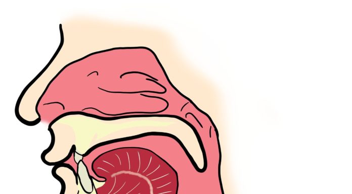 Q&A: Sinusitis and remedy choices