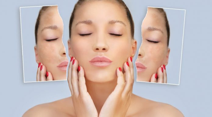 Know unwanted side effects of bleaching for pores and skin and hair