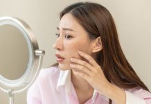 Scale back zits scars with these 5 residence cures