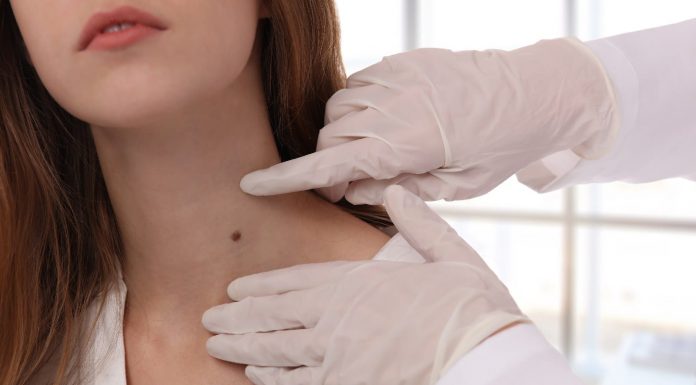 7 Warning indicators of diabetes that seem in your pores and skin