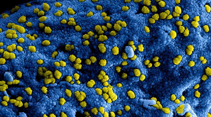 Physicians urged to think about fungal infections as attainable trigger for lung irritation