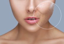 Cut back pore measurement for pimples free pores and skin with these 5 ideas