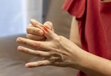 Methods to scale back uric acid naturally? 5 Tricks to know