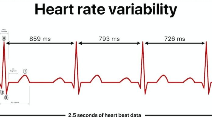 Coronary heart fee variability—what to learn about this biometric most health trackers measure