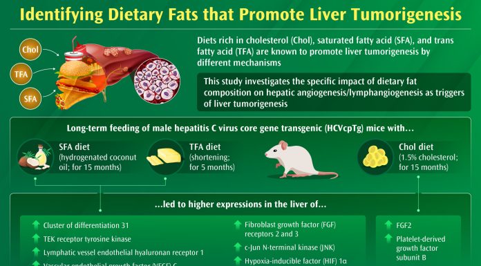 Impact of dietary fats composition on liver angiogenesis and lymphangiogenesis