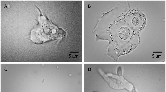 Water techniques research finds Legionella in 41% of samples