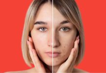 The way to deal with clogged pores in winter? 5 tricks to clear them