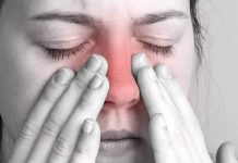 Indicators of fungal sinusitis that should not be ignored