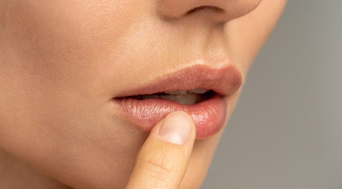 The best way to eliminate chapped lips? These 7 ideas may also help