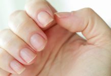 How you can clear yellow nails? Observe these 7 nail care ideas
