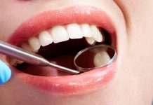 Do all of your tooth cavities require dental fillings? An knowledgeable solutions