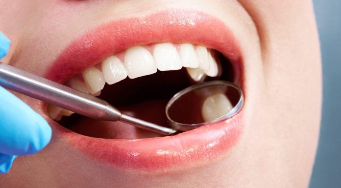 Do all of your tooth cavities require dental fillings? An knowledgeable solutions
