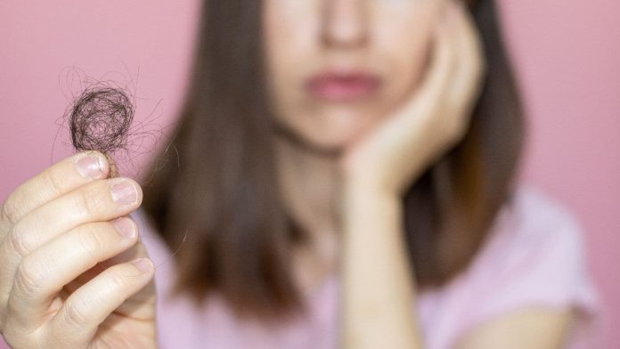 postpartum-hair-loss.jpg