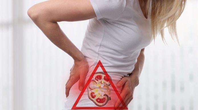 You probably have kidney stones, keep away from these meals