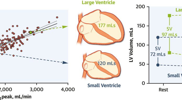 A giant coronary heart may assist preserve girls wholesome