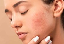Pores and skin issues could also be indicators of poor intestine well being