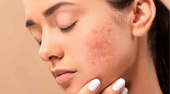 Pores and skin issues could also be indicators of poor intestine well being