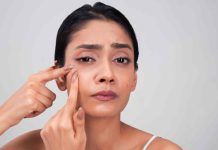 Brides, this is how one can keep away from pimples breakout