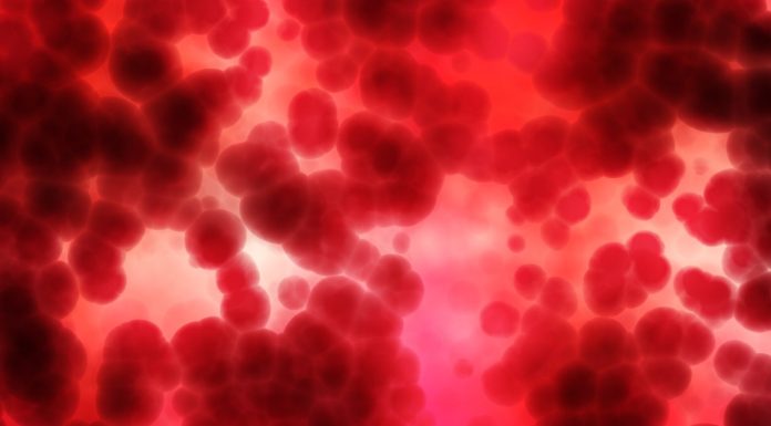 New transfusion product combining blood and plasma in a single bag saves lives, research finds
