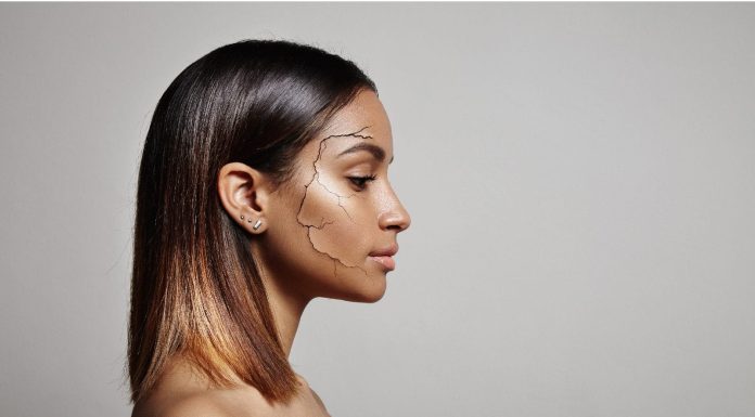 6 pure methods to take care of lifeless pores and skin in winter