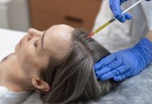 Which hair loss remedy is greatest for you?