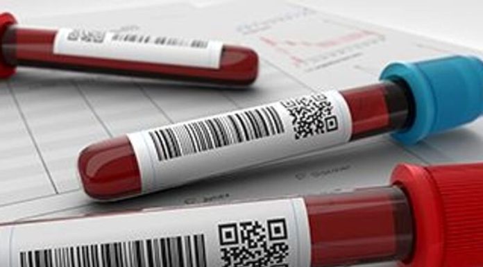 US Preventive Companies Process Power reaffirms suggestion towards genital herpes screening
