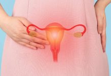 Is there a hyperlink between PCOS and thyroid?
