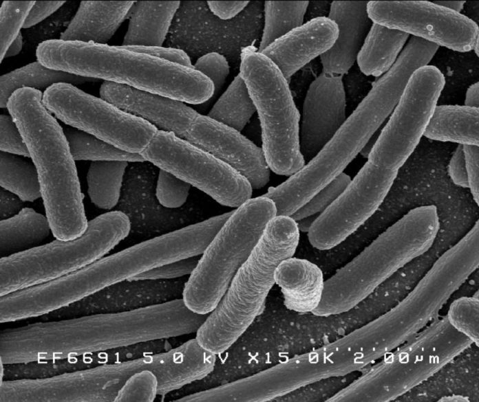 1-ecoli.jpg