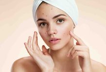 Understanding chickenpox: Signs, causes, and remedy