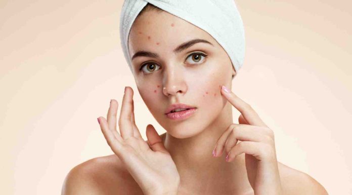Understanding chickenpox: Signs, causes, and remedy