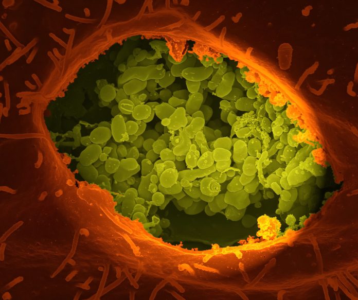 germs.jpg