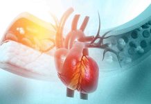 Tricks to management levels of cholesterol naturally