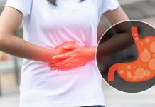 7 methods to cope with acidity submit exercise and keep away from heartburn
