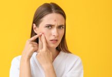 8 dangerous beauty substances that may trigger zits