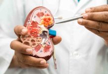 Get these 5 assessments to establish kidney ailments