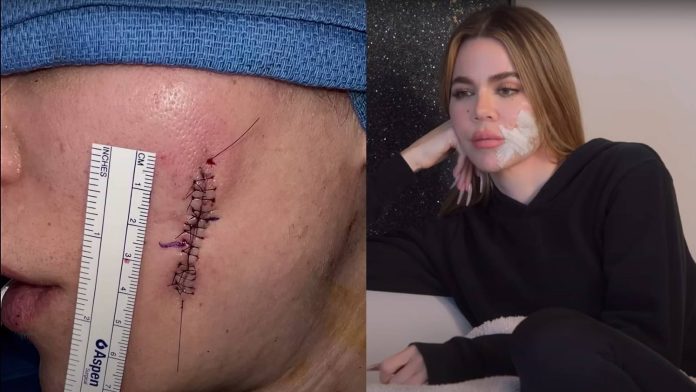 Skin-cancer.jpg
