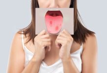 7 efficient dwelling cures to heal a burnt tongue quick